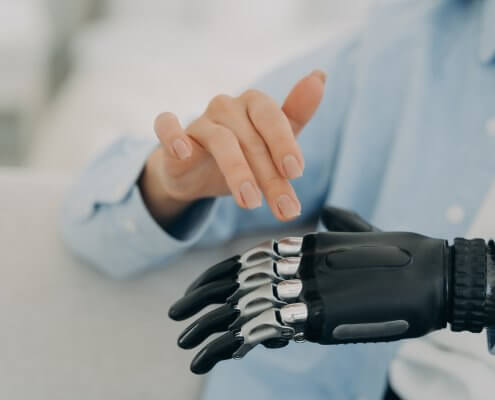 Disabled female use prosthesis of hand, artificial limb, closeup. Disability, high tech medical care